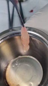 PRP en cirugia oral